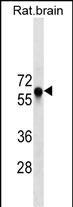 Lane 1: Rat brain tissue lysates probed with GAD2 Monoclonal Antibody, Unconjugated (bsm-51524M) at 1:1000 dilution and 4°C overnight incubation. Followed by conjugated secondary antibody incubation at 1:20000 for 60 min at 37˚C.