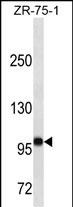Lane 1: ZR-75-1 cell lysates probed with FUT4 Monoclonal Antibody, Unconjugated (bsm-51522M) at 1:1000 dilution and 4°C overnight incubation. Followed by conjugated secondary antibody incubation at 1:20000 for 60 min at 37˚C.