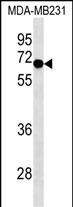 Lane 1: MDA-MB-231 cell lysates probed with SWAP70 Monoclonal Antibody, Unconjugated (bsm-51517M) at 1:1000 dilution and 4°C overnight incubation. Followed by conjugated secondary antibody incubation at 1:20000 for 60 min at 37˚C.