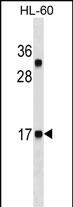 Lane 1: HL60 cell lysates probed with CALCA Monoclonal Antibody, Unconjugated (bsm-51512M) at 1:1000 dilution and 4°C overnight incubation. Followed by conjugated secondary antibody incubation at 1:20000 for 60 min at 37˚C.