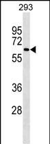 Lane 1: 293 cell lysates probed with NCOA4 Monoclonal Antibody, Unconjugated (bsm-51511M) at 1:1000 dilution and 4°C overnight incubation. Followed by conjugated secondary antibody incubation at 1:20000 for 60 min at 37˚C.