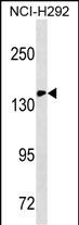 Lane 1: NCI-H292 cell lysates probed with CD11c Monoclonal Antibody, Unconjugated (bsm-51510M) at 1:1000 dilution and 4°C overnight incubation. Followed by conjugated secondary antibody incubation at 1:20000 for 60 min at 37˚C.