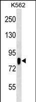 Lane 1: K562 cell lysates probed with RPS6KA3 Monoclonal Antibody, Unconjugated (bsm-51509M) at 1:1000 dilution and 4°C overnight incubation. Followed by conjugated secondary antibody incubation at 1:20000 for 60 min at 37˚C.