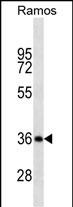 Lane 1: Ramos cell lysates probed with CD20 Monoclonal Antibody, Unconjugated (bsm-51506M) at 1:1000 dilution and 4°C overnight incubation. Followed by conjugated secondary antibody incubation at 1:20000 for 60 min at 37˚C.