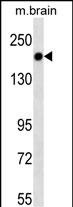 Lane 1: Mouse brain tissue lysates probed with TSC1 Monoclonal Antibody, Unconjugated (bsm-51504M) at 1:1000 dilution and 4°C overnight incubation. Followed by conjugated secondary antibody incubation at 1:20000 for 60 min at 37˚C.
