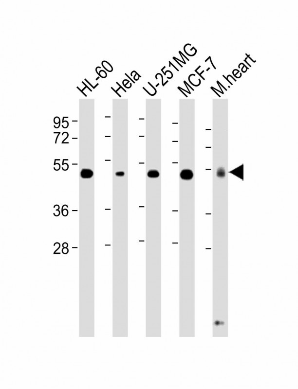Lane 1: HL-60 cell lysates; Lane 2: Hela cell lysates; Lane 3: U-251MG cell lysates; Lane 4: MCF-7 cell lysates; Lane 5: Mouse Heart tissue lysates probed with RCC1 Monoclonal Antibody, Unconjugated (bsm-51500M) at 1:2000 dilution and 4°C overnight incubation. Followed by conjugated secondary antibody incubation at 1:20000 for 60 min at 37°C.
