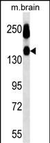 Lane 1: Mouse brain tissue lysates probed with CD56 Monoclonal Antibody, Unconjugated (bsm-51499M) at 1:1000 dilution and 4°C overnight incubation. Followed by conjugated secondary antibody incubation at 1:20000 for 60 min at 37˚C.