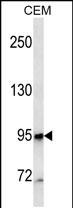 Lane 1: CEM cell lysates probed with CD10 Monoclonal Antibody, Unconjugated (bsm-51496M) at 1:1000 dilution and 4°C overnight incubation. Followed by conjugated secondary antibody incubation at 1:20000 for 60 min at 37˚C.