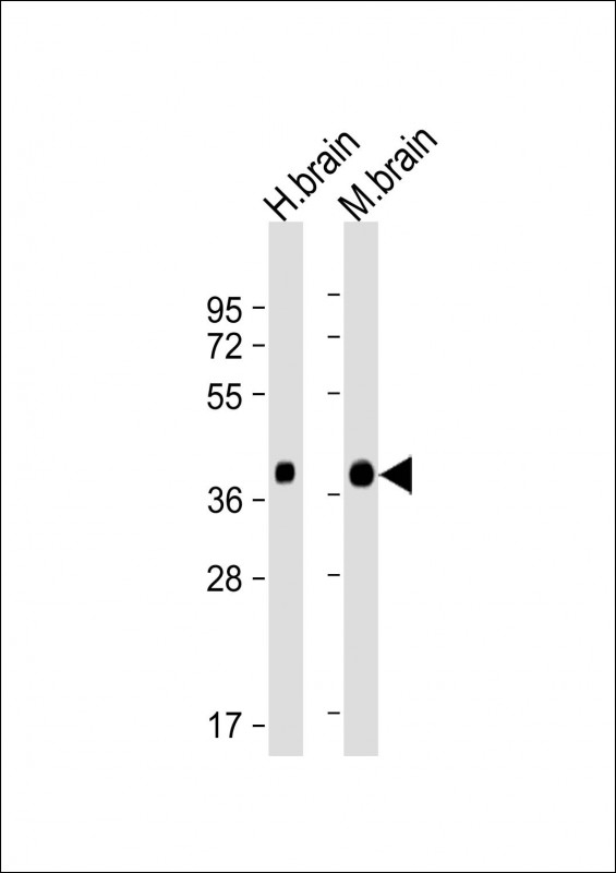 Lane 1: Human brain tissue lysates; Lane 2: Mouse brain tissue lysates probed with Synaptophysin Monoclonal Antibody, Unconjugated (bsm-51494M) at 1:4000 dilution and 4°C overnight incubation. Followed by conjugated secondary antibody incubation at 1:20000 for 60 min at 37˚C.