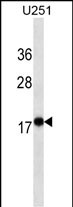 Lane 1: U251 cell lysates probed with EIF4EBP1 Monoclonal Antibody, Unconjugated (bsm-51493M) at 1:1000 dilution and 4°C overnight incubation. Followed by conjugated secondary antibody incubation at 1:20000 for 60 min at 37˚C.