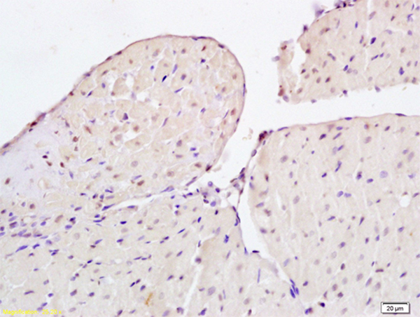 Formalin-fixed and paraffin embedded rat heart tissue labeled with Anti-CIDEC Polyclonal Antibody, Unconjugated (bs-6796R) at 1:200 followed by conjugation to the secondary antibody and DAB staining