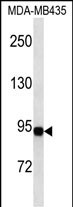 Lane 1: MDA-MB435 cell lysates probed with Gelsolin Monoclonal Antibody, Unconjugated (bsm-51492M) at 1:1000 dilution and 4°C overnight incubation. Followed by conjugated secondary antibody incubation at 1:20000 for 60 min at 37˚C.