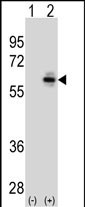 Lane 1: 293 cell lysates; Lane 2: transiently transfected with the CDC25C gene probed with CDC25C Monoclonal Antibody, Unconjugated (bsm-51488M) at 1:1000 dilution and 4°C overnight incubation. Followed by conjugated secondary antibody incubation at 1:20000 for 60 min at 37˚C.