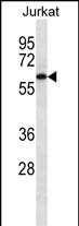 Lane 1: Jurkat cell lysates probed with CAMKK2 Monoclonal Antibody, Unconjugated (bsm-51487M) at 1:1000 dilution and 4°C overnight incubation. Followed by conjugated secondary antibody incubation at 1:20000 for 60 min at 37˚C.