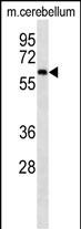 Lane 1: Mouse Cerebellum tissue lysates probed with CAMKK2 Monoclonal Antibody, Unconjugated (bsm-51487M) at 1:1000 dilution and 4°C overnight incubation. Followed by conjugated secondary antibody incubation at 1:20000 for 60 min at 37˚C.