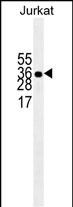 Lane 1: Jurkat cell lysates probed with ELAVL1 Monoclonal Antibody, Unconjugated (bsm-51486M) at 1:1000 dilution and 4°C overnight incubation. Followed by conjugated secondary antibody incubation at 1:20000 for 60 min at 37˚C.