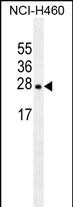 Lane 1: NCL-H460 cell lysates probed with EIF4E2 Monoclonal Antibody, Unconjugated (bsm-51485M) at 1:1000 dilution and 4°C overnight incubation. Followed by conjugated secondary antibody incubation at 1:20000 for 60 min at 37˚C.