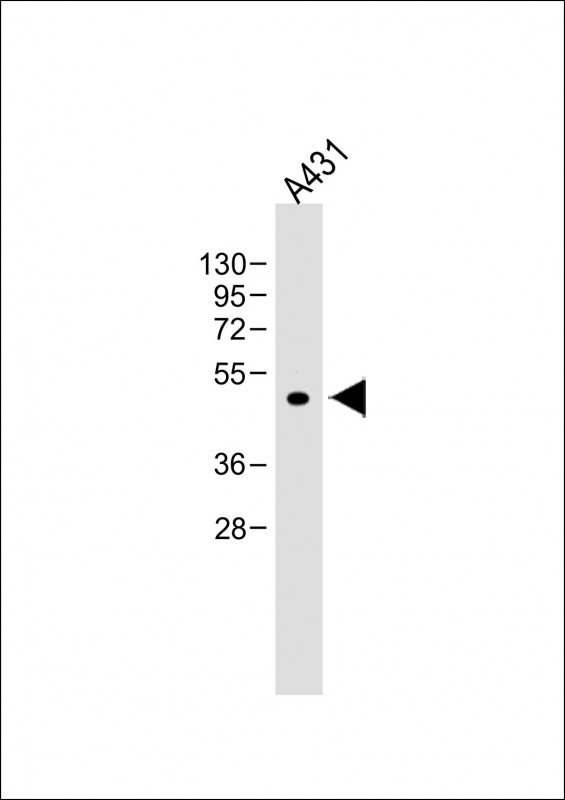 Lane 1: A431 cell lysates probed with ATG4D Monoclonal Antibody, Unconjugated (bsm-51484M) at 1:4000 dilution and 4°C overnight incubation. Followed by conjugated secondary antibody incubation at 1:20000 for 60 min at 37˚C.
