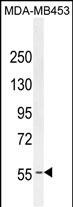 Lane 1: MDA-MB453 cell lysates probed with ESR1 Monoclonal Antibody, Unconjugated (bsm-51481M) at 1:1000 dilution and 4°C overnight incubation. Followed by conjugated secondary antibody incubation at 1:20000 for 60 min at 37˚C.