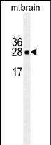 Lane 1: Mouse brain tissue lysates probed with LXN Monoclonal Antibody, Unconjugated (bsm-51480M) at 1:1000 dilution and 4°C overnight incubation. Followed by conjugated secondary antibody incubation at 1:20000 for 60 min at 37˚C.