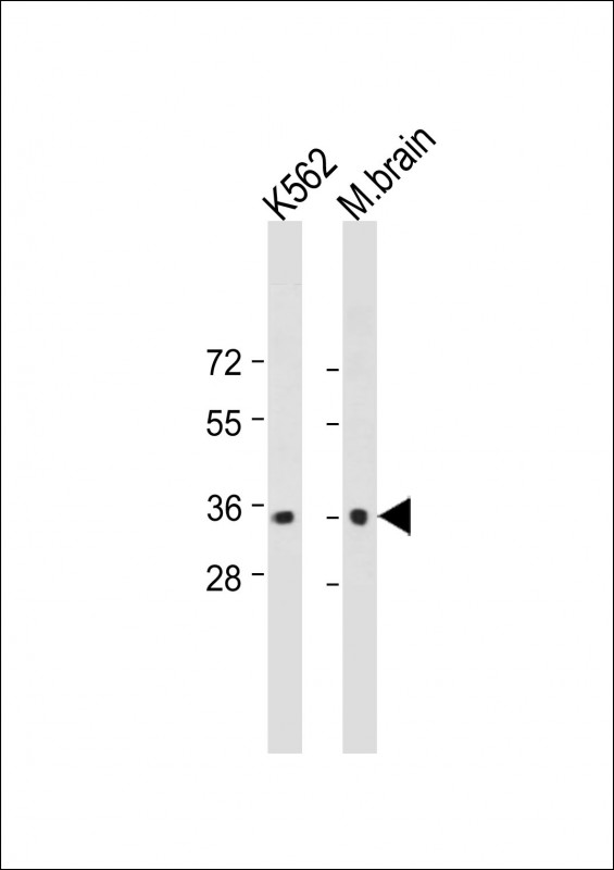 Lane 1: K562 cell lysates; Lane 2: Mouse Brain tissue lysates probed with CAB39 Monoclonal Antibody, Unconjugated (bsm-51478M) at 1:1000 dilution and 4°C overnight incubation. Followed by conjugated secondary antibody incubation at 1:20000 for 60 min at 37˚C.