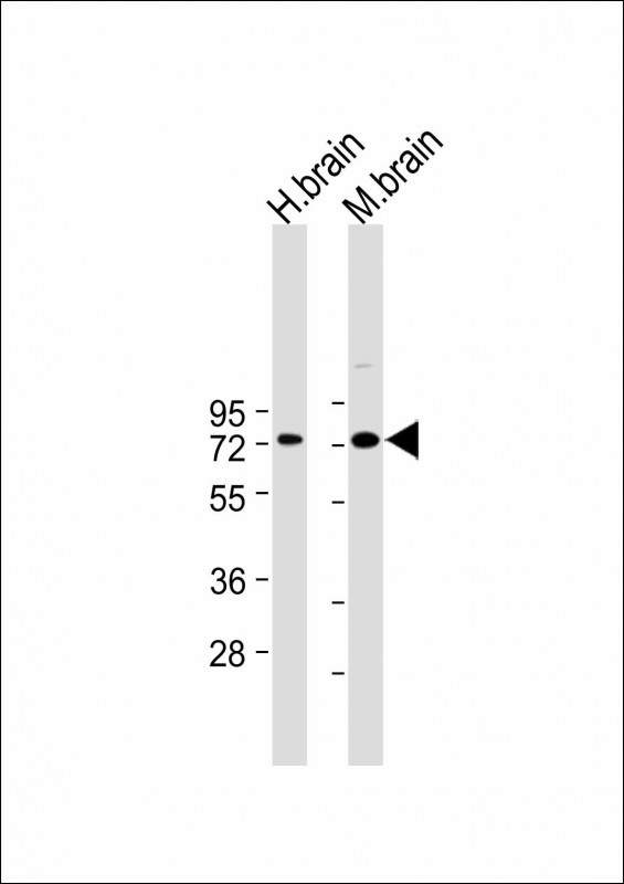 Lane 1: Human Brain tissue lysates; Lane 2: Mouse Brain tissue lysates probed with LIMK1 Monoclonal Antibody, Unconjugated (bsm-51477M) at 1:1000 dilution and 4°C overnight incubation. Followed by conjugated secondary antibody incubation at 1:20000 for 60 min at 37˚C.