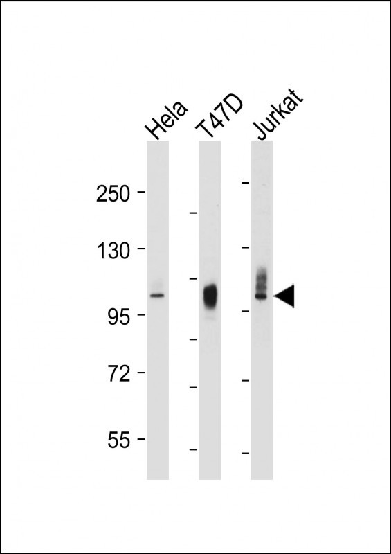 Lane 1: Hela cell lysates; Lane 2: T47D cell lysates; Lane 3: Jurkat cell lysates probed with LAMP2 Monoclonal Antibody, Unconjugated (bsm-51474M) at 1:2000 dilution and 4°C overnight incubation. Followed by conjugated secondary antibody incubation at 1:20000 for 60 min at 37˚C.