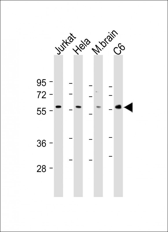 Lane 1: Jurkat cell lysates; Lane 2: Hela cell lysates; Lane 3: Mouse brain tissue lysates; Lane 4: C6 cell lysates probed with AKT2 Monoclonal Antibody, Unconjugated (bsm-51473M) at 1:1000 dilution and 4°C overnight incubation. Followed by conjugated secondary antibody incubation at 1:20000 for 60 min at 37˚C.