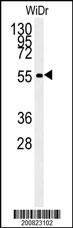 Lane 1: WiDr cell lysates probed with ALDH3A2 Monoclonal Antibody, Unconjugated (bsm-51470M) at 1:1000 dilution and 4°C overnight incubation. Followed by conjugated secondary antibody incubation at 1:20000 for 60 min at 37˚C.