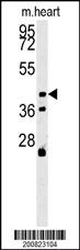 Lane 1: Mouse Heart tissue lysates probed with ALDH3A2 Monoclonal Antibody, Unconjugated (bsm-51470M) at 1:1000 dilution and 4°C overnight incubation. Followed by conjugated secondary antibody incubation at 1:20000 for 60 min at 37˚C.