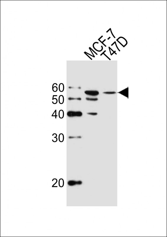 Lane 1: MCF-7 cell lysates; Lane 2: T47D cell lysate probed with ALDH6A1 Monoclonal Antibody, Unconjugated (bsm-51469M) at 1:1000 dilution and 4°C overnight incubation. Followed by conjugated secondary antibody incubation at 1:20000 for 60 min at 37˚C.