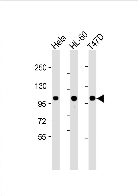Lane 1: Hela cell lysates; Lane 2: HL-60 cell lysates; Lane 3: T47D cell lysates probed with EZH2 Monoclonal Antibody, Unconjugated (bsm-51468M) at 1:2000 dilution and 4°C overnight incubation. Followed by conjugated secondary antibody incubation at 1:20000 for 60 min at 37˚C.
