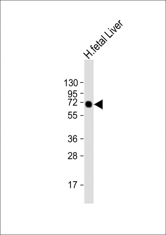 Lane 1: Human Fetal Liver tissue lysates probed with AFP Monoclonal Antibody, Unconjugated (bsm-51467M) at 1:2000 dilution and 4°C overnight incubation. Followed by conjugated secondary antibody incubation at 1:20000 for 60 min at 37˚C.