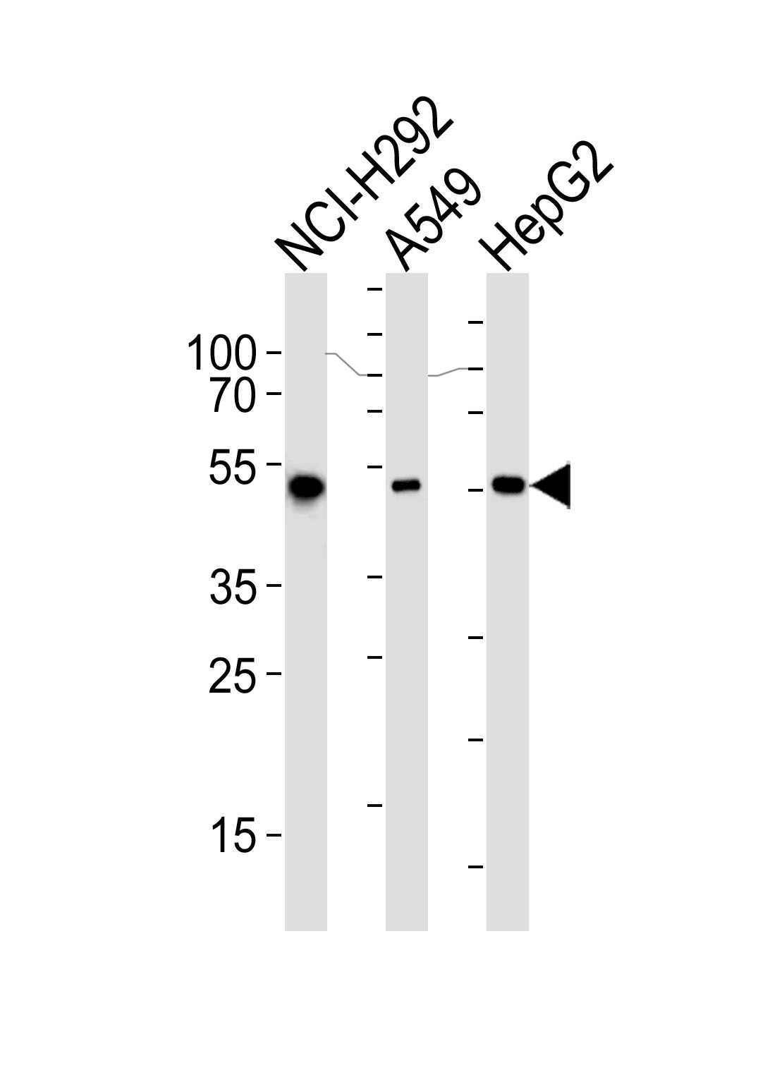 Lane 1: NCI-H292 cell lysates; Lane 2: A549 cell lysates; Lane 3: HepG2 cell lysates probed with ALDH2 Monoclonal Antibody, Unconjugated (bsm-51466M) at 1:1000 dilution and 4°C overnight incubation. Followed by conjugated secondary antibody incubation at 1:20000 for 60 min at 37˚C.