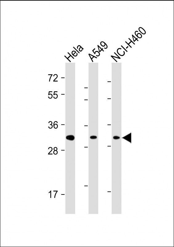Lane 1: Hela cell lysates; Lane 2: A549 cell lysates; Lane 3: NCI-H460 cell lysates probed with SNAIL Monoclonal Antibody, Unconjugated (bsm-51463M) at 1:500 dilution and 4°C overnight incubation. Followed by conjugated secondary antibody incubation at 1:20000 for 60 min at 37˚C.