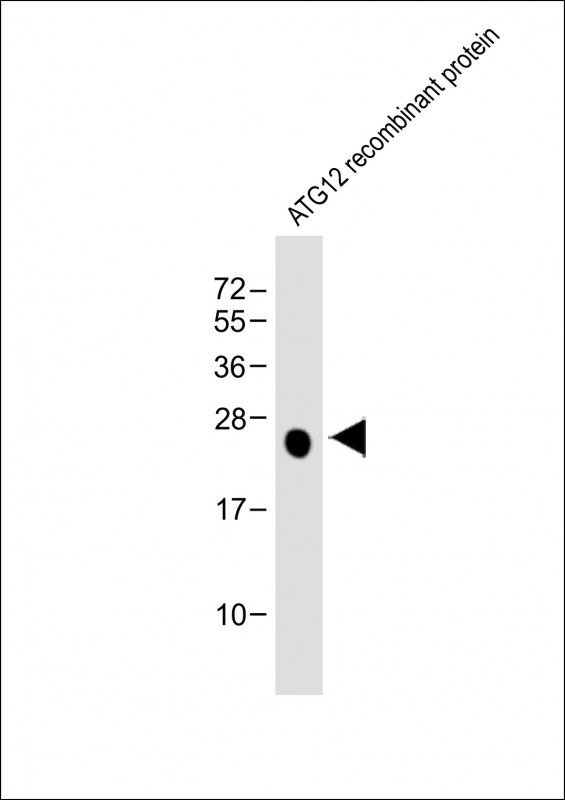 Lane 1: ATG12 Recombinant protein probed with ATG12 Monoclonal Antibody, Unconjugated (bsm-51462M) at 1:4000 dilution and 4°C overnight incubation. Followed by conjugated secondary antibody incubation at 1:20000 for 60 min at 37˚C.