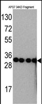 Lane 1: Recombinant APG7 protein probed with ATG7 Monoclonal Antibody, Unconjugated (bsm-51461M) at 1:1000 dilution and 4°C overnight incubation. Followed by conjugated secondary antibody incubation at 1:20000 for 60 min at 37˚C.