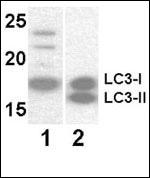 Lane 1: Y79 (soluble fraction of cell extract) cell lysates; Lane 2: 293 transfected with human LC3 (whole cell extract) cell lysates probed with LC3 Monoclonal Antibody, Unconjugated (bsm-51460M) at 1:1000 dilution and 4°C overnight incubation. Followed by conjugated secondary antibody incubation at 1:20000 for 60 min at 37˚C.