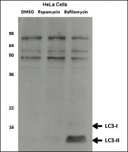 Hela cell lysates, which were treated with rapamycin or bafilomycin overnight. Data courtesy of Dr. David Rubinsztein, Cambridge Institute for Medical Research. probed with LC3 Monoclonal Antibody, Unconjugated (bsm-51460M) at 1:1000 dilution and 4°C overnight incubation. Followed by conjugated secondary antibody incubation at 1:20000 for 60 min at 37˚C.