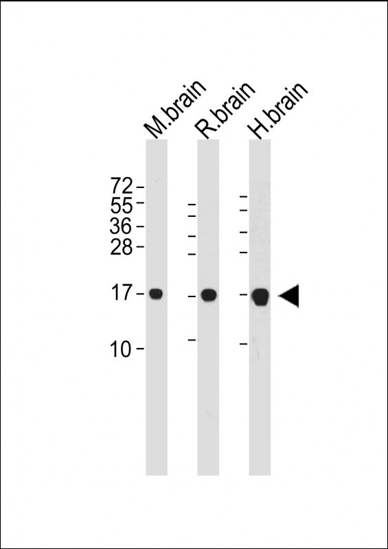 Lane 1: Mouse Brain tissue lysates; Lane 2: Rat Brain tissue lysates; Lane 3: Human Brain tissue lysates probed with LC3 Monoclonal Antibody, Unconjugated (bsm-51460M) at 1:1000 dilution and 4°C overnight incubation. Followed by conjugated secondary antibody incubation at 1:20000 for 60 min at 37˚C.