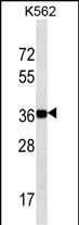 Lane 1: Human K562 cell lysates probed with NANOG Monoclonal Antibody, Unconjugated (bsm-51459M) at 1:1000 dilution and 4°C overnight incubation. Followed by conjugated secondary antibody incubation at 1:20000 for 60 min at 37˚C.