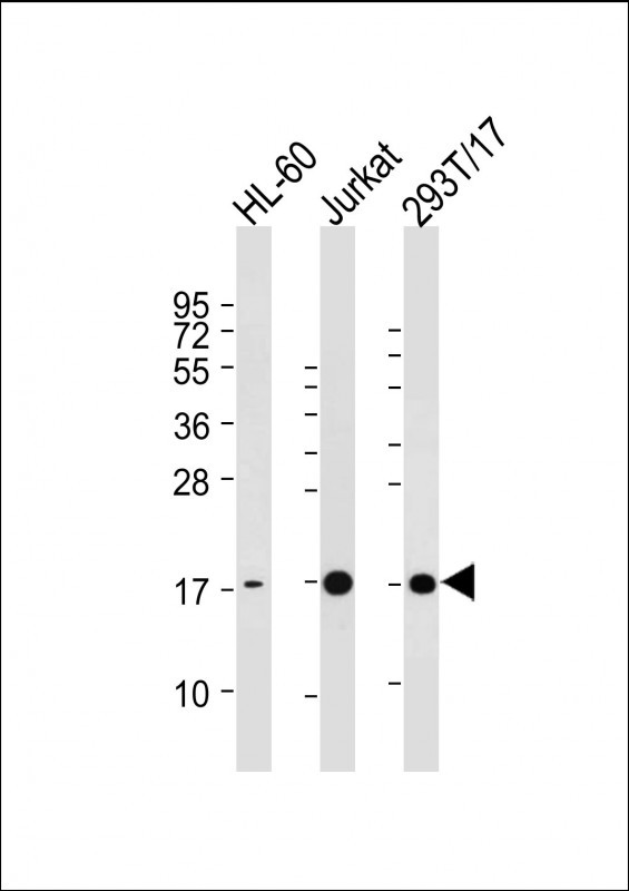 Lane 1: HL-60 cell lysates; Lane 2: Jurkat cell lysates; Lane 3: 293T/17 cell lysates probed with SUMO3 Monoclonal Antibody, Unconjugated (bsm-51458M) at 1:2000 dilution and 4°C overnight incubation. Followed by conjugated secondary antibody incubation at 1:20000 for 60 min at 37˚C.