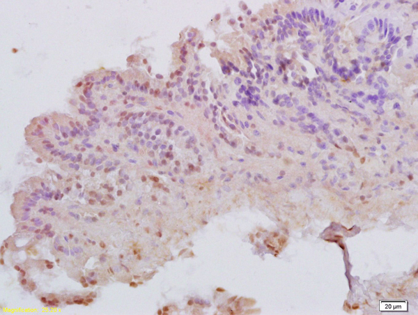Formalin-fixed and paraffin embedded rat colitis tissue labeled with Anti-MATH1 Polyclonal Antibody, Unconjugated (bs-3522R) at 1:200 followed by conjugation to the secondary antibody and DAB staining
