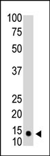 Lane 1: HL-60 cell lysates probed with SUMO1 Monoclonal Antibody, Unconjugated (bsm-51457M) at 1:1000 dilution and 4°C overnight incubation. Followed by conjugated secondary antibody incubation at 1:20000 for 60 min at 37˚C.