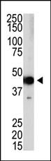 Lane 1: 293 cell lysates probed with PRDM12 Monoclonal Antibody, Unconjugated (bsm-51456M) at 1:1000 dilution and 4°C overnight incubation. Followed by conjugated secondary antibody incubation at 1:20000 for 60 min at 37˚C.