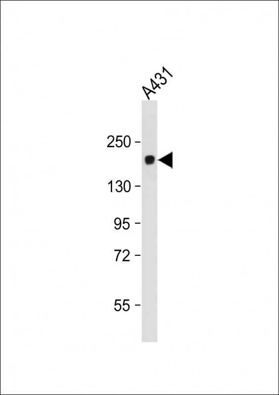 Lane 1: A431 cell lysates probed with PRDM10 Monoclonal Antibody, Unconjugated (bsm-51455M) at 1:1000 dilution and 4°C overnight incubation. Followed by conjugated secondary antibody incubation at 1:20000 for 60 min at 37°C.
