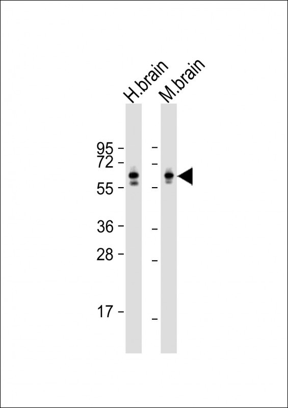 Lane 1: Human Brain tissue lysates; Lane 2: Mouse Brain tissue lysates probed with CRMP2 Monoclonal Antibody, Unconjugated (bsm-51453M) at 1:8000 dilution and 4°C overnight incubation. Followed by conjugated secondary antibody incubation at 1:20000 for 60 min at 37°C.