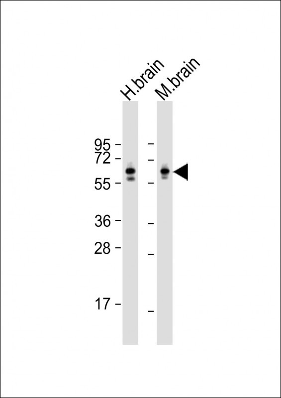 Lane 1: Human Brain tissue lysates; Lane 2: Mouse Brain tissue lysates probed with CRMP2 Monoclonal Antibody, Unconjugated (bsm-51453M) at 1:8000 dilution and 4°C overnight incubation. Followed by conjugated secondary antibody incubation at 1:20000 for 60 min at 37˚C.