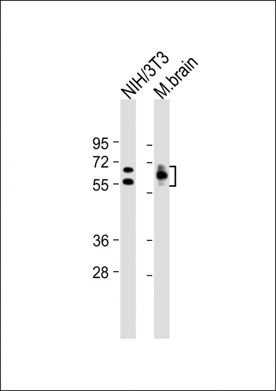 Lane 1: Mouse NIH/3T3 cell lysates; Lane 2: Mouse Brain tissue lysates probed with CRMP2 Monoclonal Antibody, Unconjugated (bsm-51453M) at 1:12800 dilution and 4°C overnight incubation. Followed by conjugated secondary antibody incubation at 1:20000 for 60 min at 37°C.