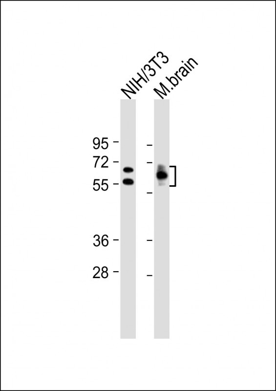 Lane 1: Mouse NIH/3T3 cell lysates; Lane 2: Mouse Brain tissue lysates probed with CRMP2 Monoclonal Antibody, Unconjugated (bsm-51453M) at 1:12800 dilution and 4°C overnight incubation. Followed by conjugated secondary antibody incubation at 1:20000 for 60 min at 37˚C.